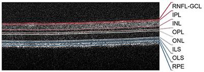 Normative mice retinal thickness: 16-month longitudinal characterization of wild-type mice and changes in a model of Alzheimer's disease